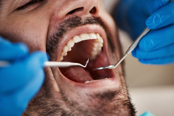 Best Urgent Care for Lost Fillings or Crowns in Dunkirk, IN